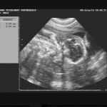 ultrsound scan of a kitten